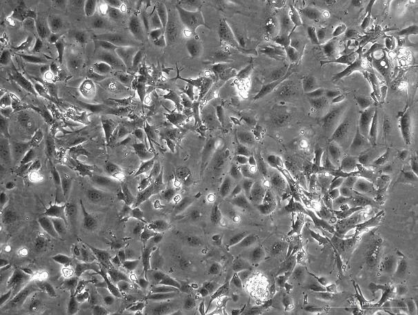 Epithelial Cells