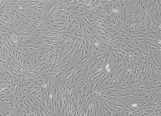 Adipose-derived Mesenchymal Stem Cells (ADSCs)