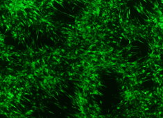 Labeled Bone Marrow Mesenchymal Stem Cells