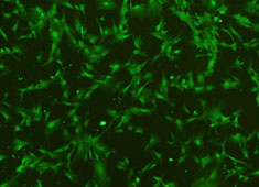 Labeled Adipose-derived Mesenchymal Stem Cells