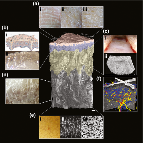 Skin structure highlighting dermis and location of dermal fibroblasts