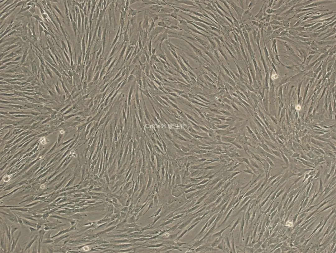 Human dermal fibroblast morphology in culture (spindle-shaped cells)