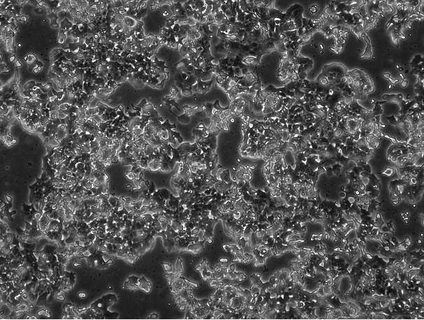 OriCell™ Beta-TC-6 Mouse Insulinoma Islet β-Cell Line
