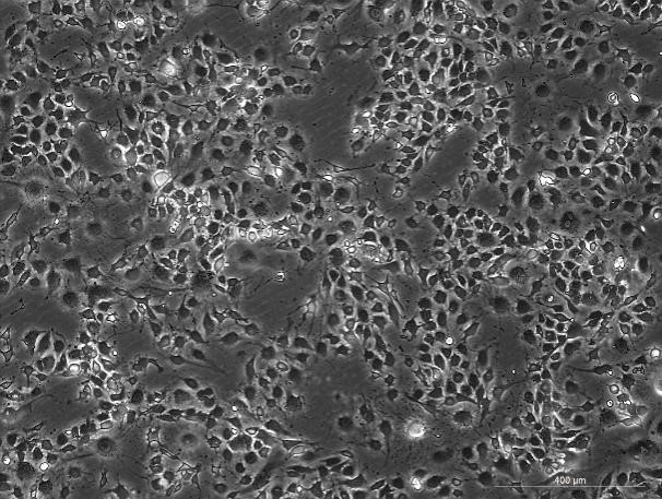 OriCell™ EOMA Mouse Hemangioendothelioma Cell Line