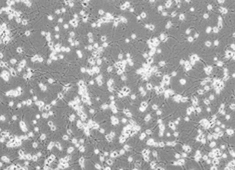 F344 Fetal Rat Hippocampal Neurons