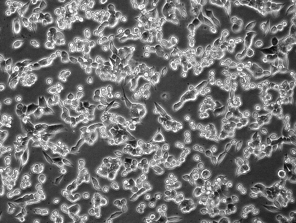 LL/2 (LLC1) Mouse Lewis Lung Cancer Cell Line