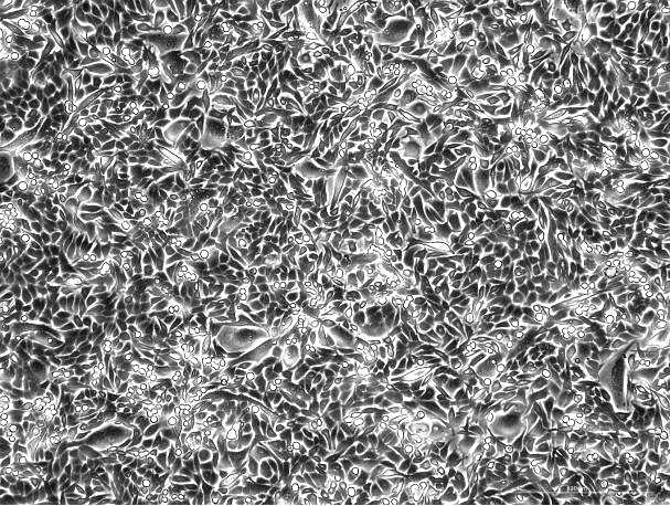 KLN 205 Mouse Lung Squamous Cell Carcinoma Cell Line M0-0201