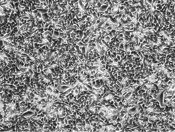 KLN 205 Mouse Lung Squamous Cell Carcinoma Cell Line