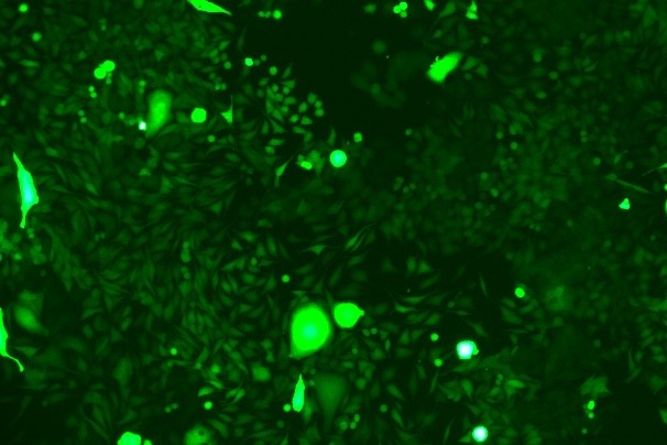 KLN 205 Mouse Lung Squamous Cell Carcinoma Cell Line with GFP-M0-0203