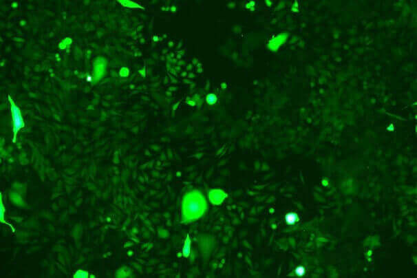 KLN 205 Mouse Lung Squamous Cell Carcinoma Cell Line with GFP-M0-0203