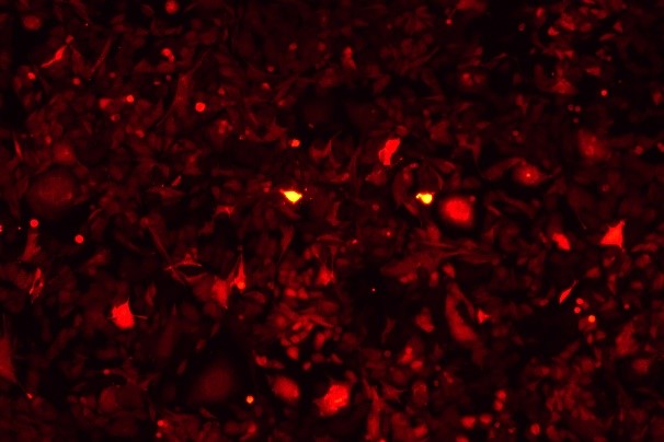 KLN 205 Mouse Lung Squamous Cell Carcinoma Cell Line with RFP-M0-0204