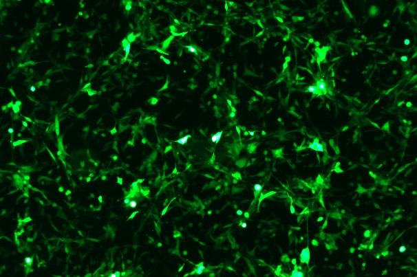 MC38 Mouse Colon Cancer Cell Line with GFP-M1-0403