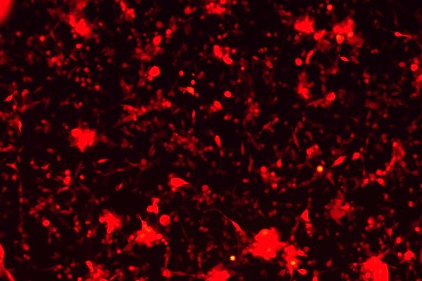 MC38 Mouse Colon Cancer Cell Line with RFP-M1-0404