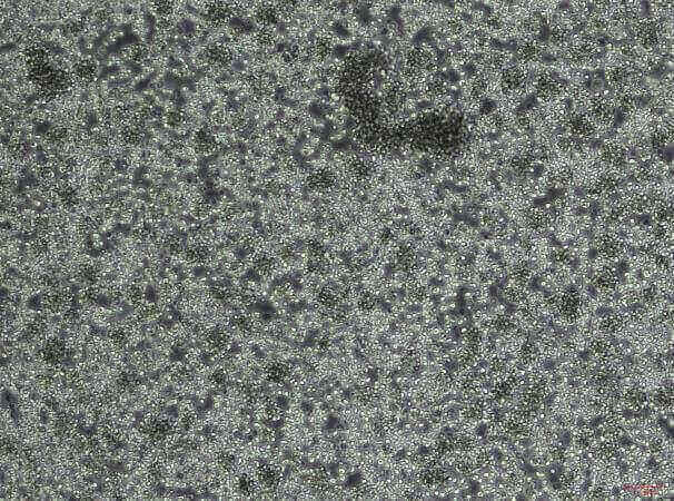 H22 Mouse Liver Cancer Cell Line-M1-0601