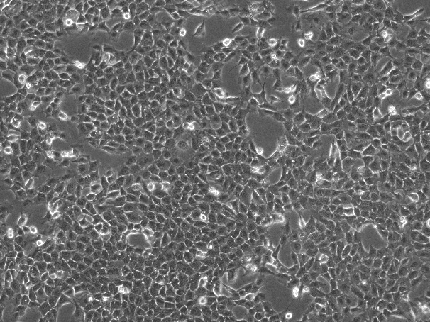 KPC Mouse Pancreatic Cancer Cell Line-M1-1001