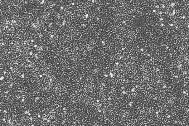 CMT93 Mouse Rectal Polyploid Cancer Cell Line-M1-1201