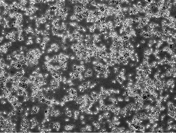AtT-20 Mouse Pituitary Tumor Cell Line-M2-0101