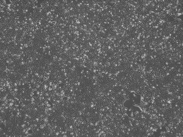 4T1 Mouse Breast Cancer Cell Line-M2-0201