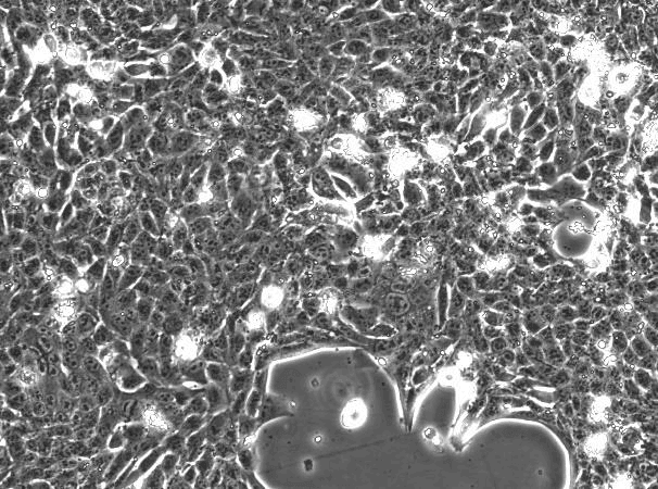 4T1 Mouse Breast Cancer Cell Line with LUC-M2-0202