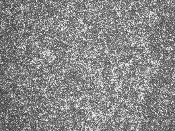 Pan02 Mouse Pancreatic Cancer Cell Line-M2-0501