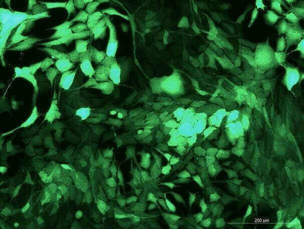 Pan02 Mouse Pancreatic Cancer Cell Line with GFP-M2-0503