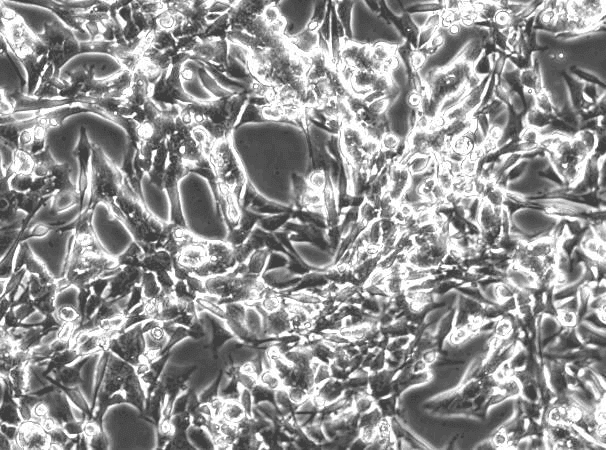 AT-3 Mouse Breast Cancer Cell Line-M2-0901