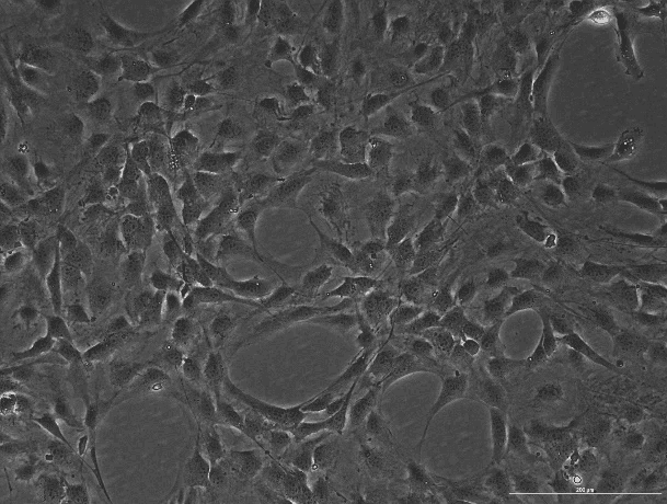 NIH/3T3 Mouse Embryonic Fibroblast Cell Line