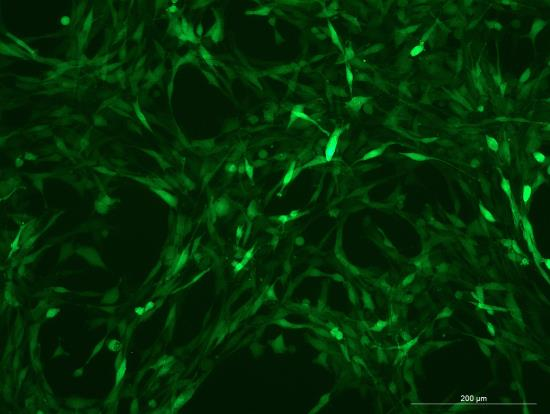YUMM1.7 Mouse Melanoma Cell Line with GFP-M5-0703