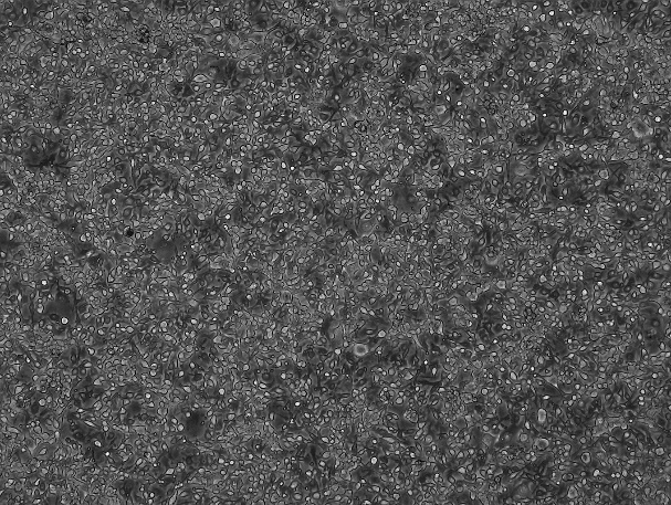 B16-F10 Mouse Skin Melanoma Cell Line-M5-0801