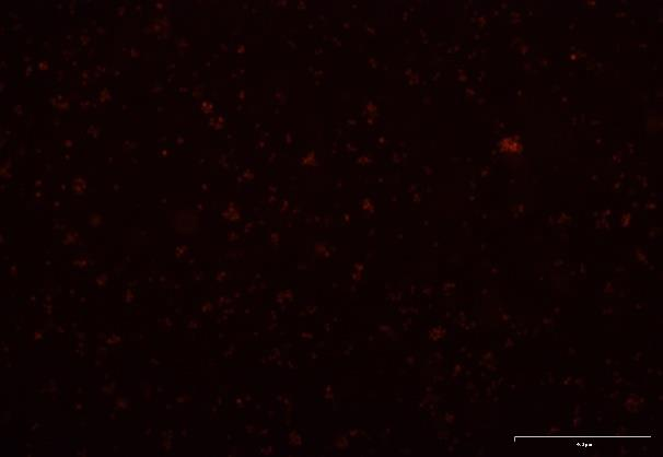 A20 Mouse B Cell Lymphoma Cell Line with Luciferase & RFP-M5-1606