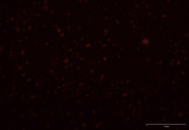 A20 Mouse B Cell Lymphoma Cell Line with Luciferase & RFP-M5-1606
