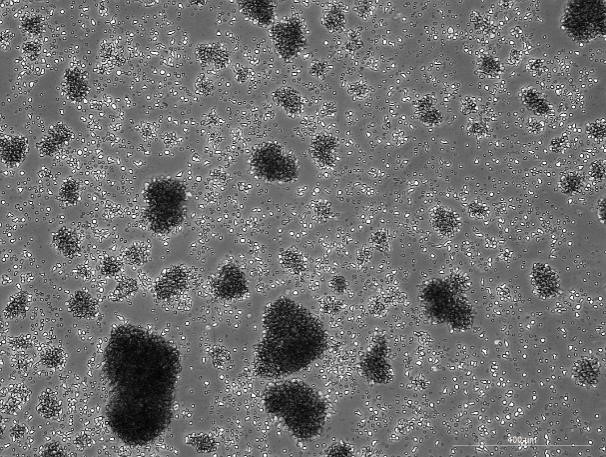 YAC-1 Mouse Lymphoma Cell Line-M5-2301