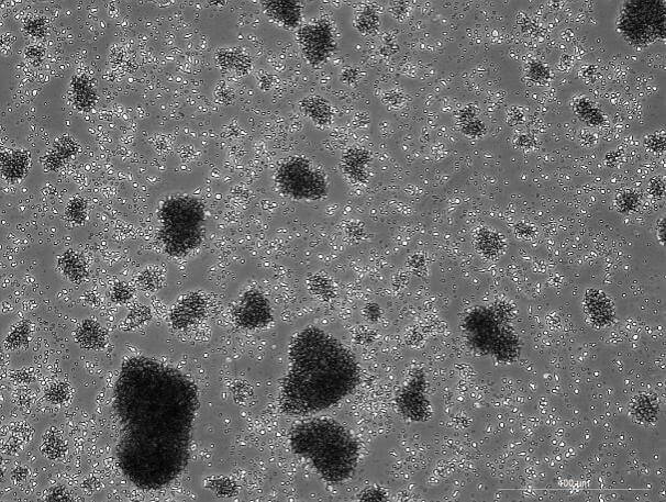 YAC-1 Mouse Lymphoma Cell Line