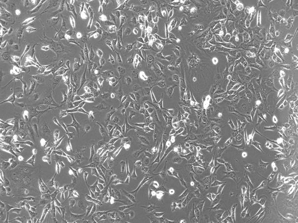 SVEC4-10 Mouse Lymph Node Endothelial Cell Line-M5-2601