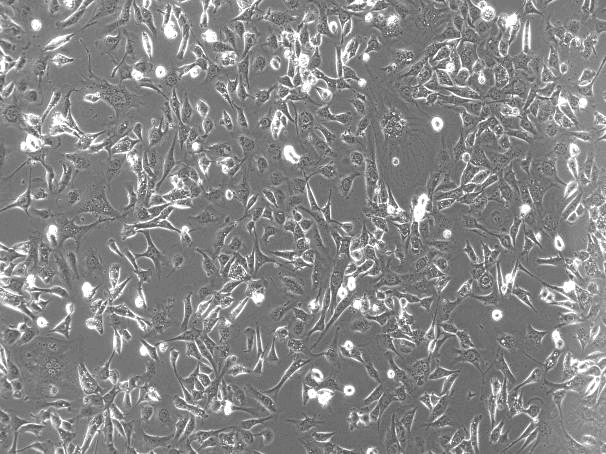 SVEC4-10 Mouse Lymph Node Endothelial Cell Line-M5-2601