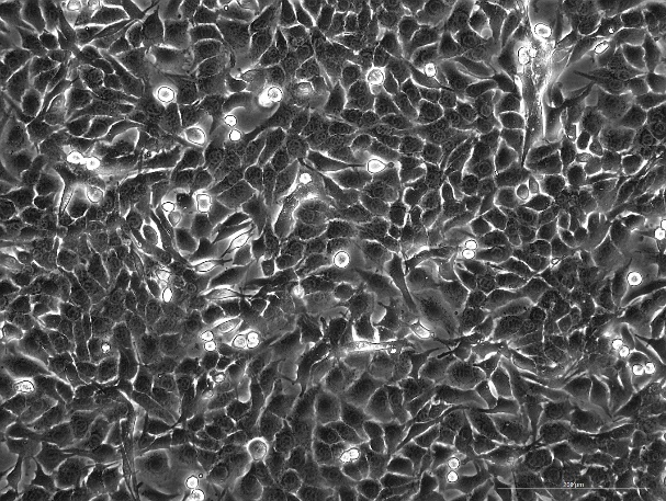 MC3T3-E1 Subclone 14 Mouse Calvarial Preosteoblast Subclone 14 Cell Line-M7-0201