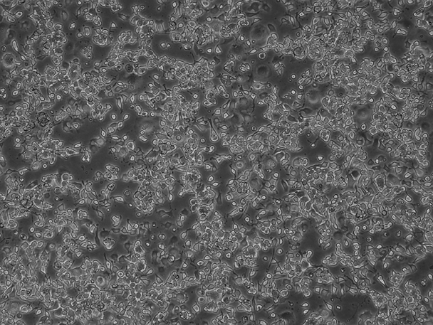 Neuro-2a Mouse Neuroblastoma Cell Line-M8-0101