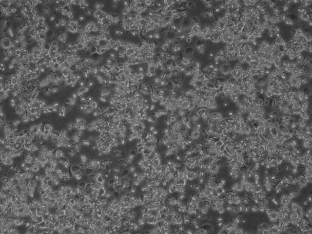Neuro-2a Mouse Neuroblastoma Cell Line-M8-0101