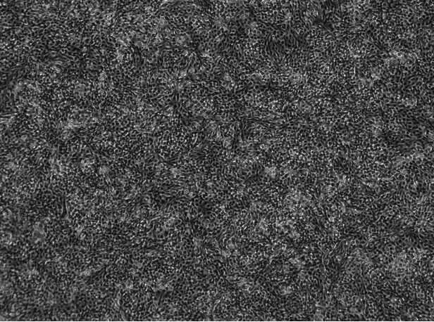 BEND.3 Mouse Brain Microvascular Endothelial Cell Line-M8-0501