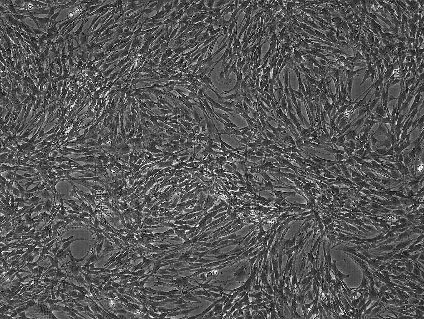 C57BL/6 Mouse Bone Marrow Mesenchymal Stem Cells-MUBMX-01001