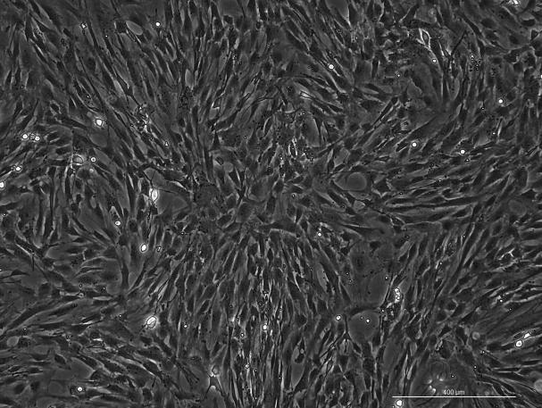 C57BL/6 Mouse Skeletal Muscle Cells