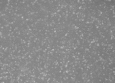 Fibroblasts