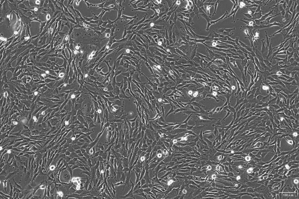 RF/6A Monkey Retinal Endothelial Cell Line-O8-0101