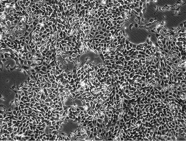 IPEC-J2 Porcine Small Intestinal Epithelial Cell Line