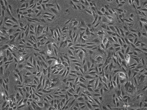 A7r5 Rat Thoracic Aortic Smooth Muscle Cell Line