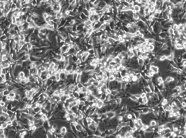 9L/lacZ Rat Gliosarcoma Cell Line R8-0401