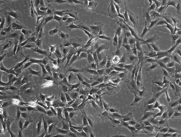 SD Rat Aortic Smooth Muscle Cells