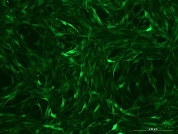 SD Rat Bone Marrow Mesenchymal Stem Cells With GFP