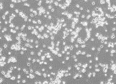 SD Fetal Rat Cortical Neurons