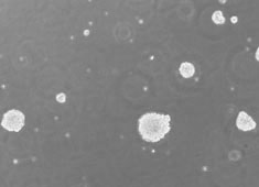 Neural Stem Cells (NSCs)